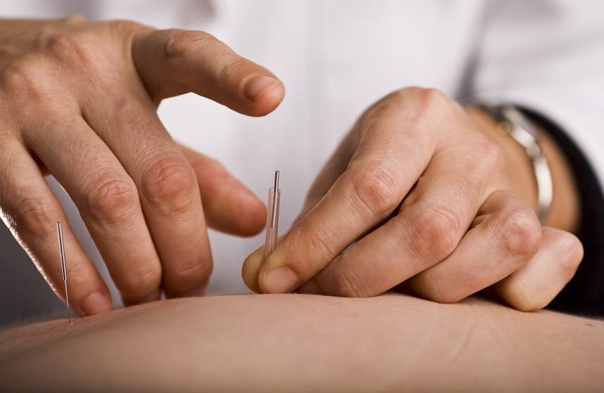 IMS and acupuncture