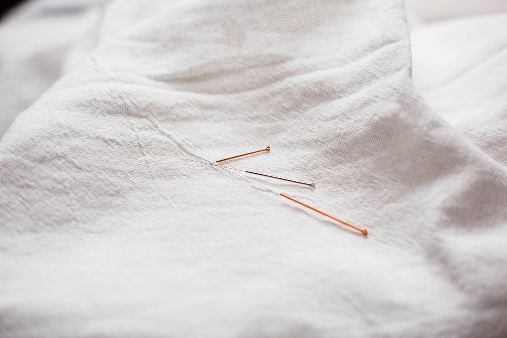Acupuncture can help with cardiovascular issues